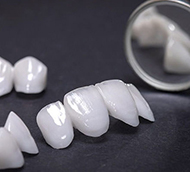 Implantes dentales en Ronda