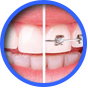 Implantes dentales en Ronda